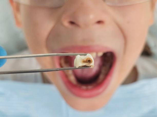 Best Urgent Dental Care for Toothaches in Woodville, AL