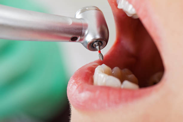 Best Emergency Root Canal Therapy in Woodville, AL